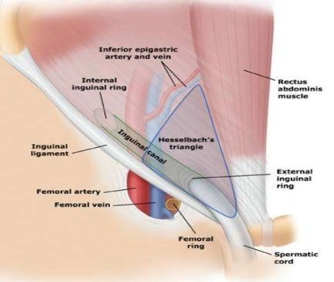 hernia_Anatomy.jpg