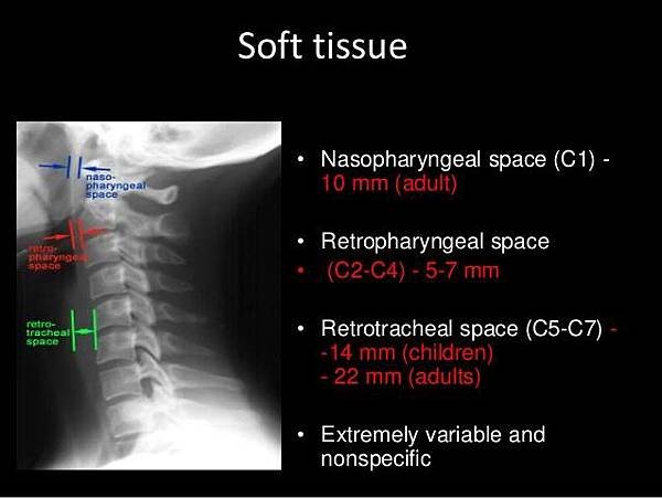 soft tissue.jpg