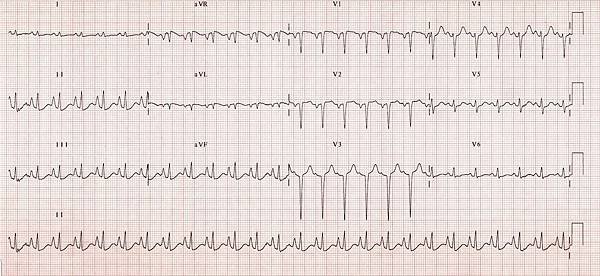 Pulmonary-disease-pattern.jpg