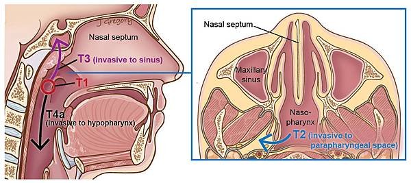 39Nasophayrnx_Tstages.jpg