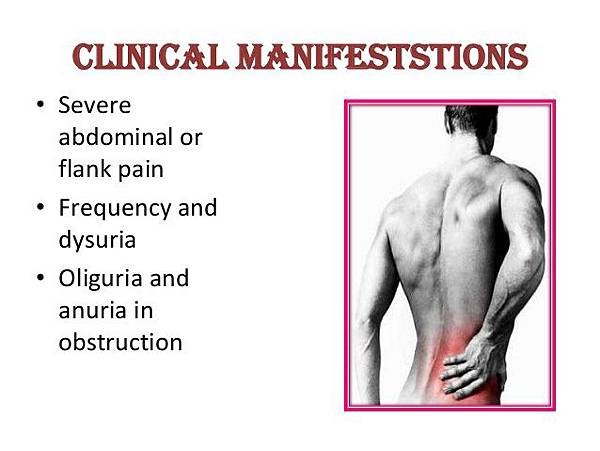 renal-calculi-ppt-15-638.jpg