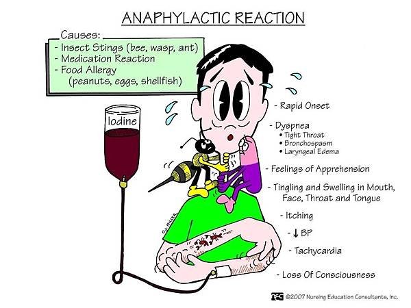 anaphylaxis05_orig.jpg