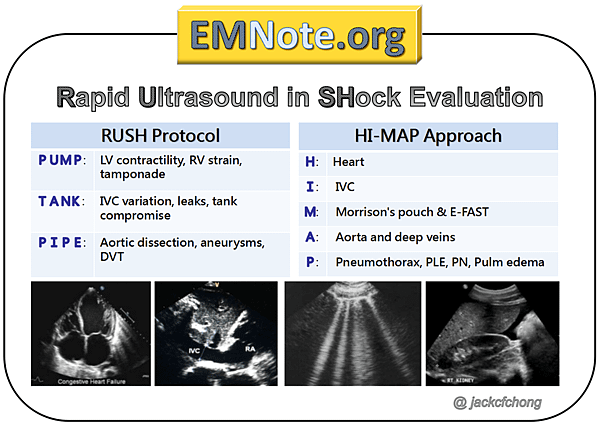 rushshock01_orig.png