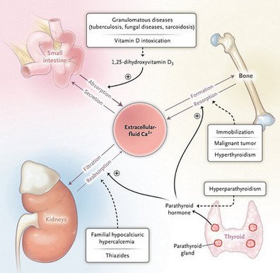 Hypercalcemia-Causes.jpg