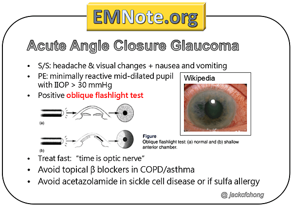 glaucomanote01_orig.png