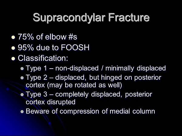 Supracondylar+Fracture.jpg