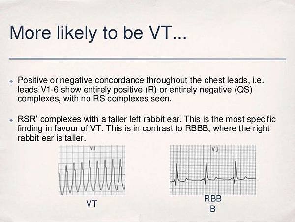 advanced-ecgs-48-638.jpg