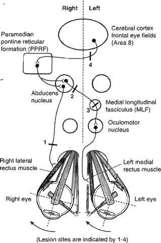 9539_212_246-horizontal-eyer-gaze.jpg