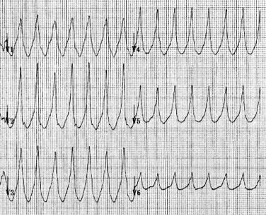 ECG-Exigency-004-d.jpg