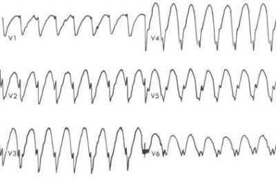 ECG-Exigency-004-e.jpg