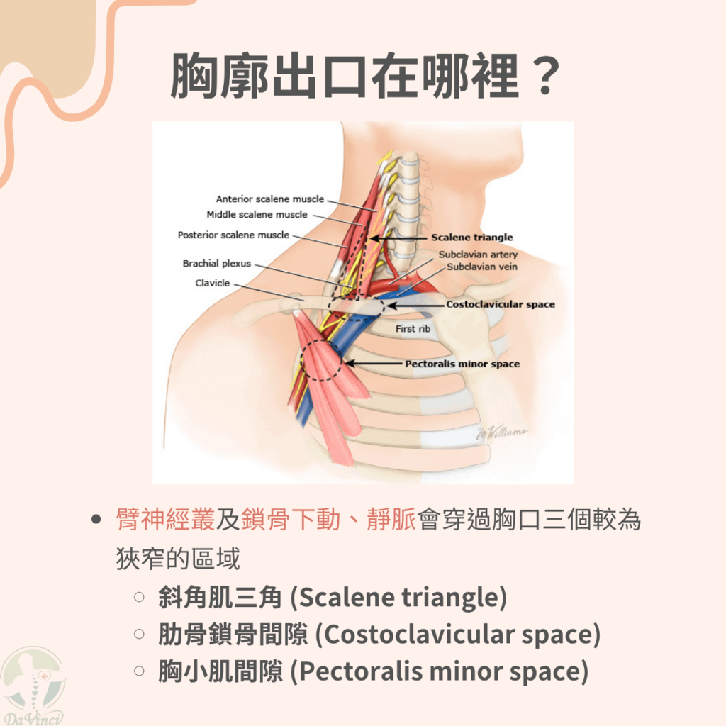 上班當中肩頸痠痛、手麻無力？ 當心胸廓出口症候群！