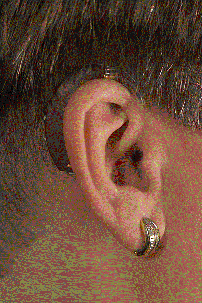 20-Brown-BTE-on-ear