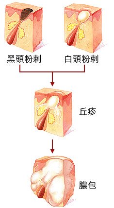 皮膚生理學03