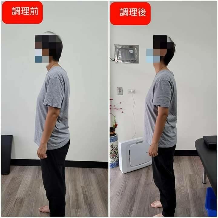 台南整骨推薦│元強仙骨微調│駝背拜拜！讓身體輕鬆站直，抬頭挺