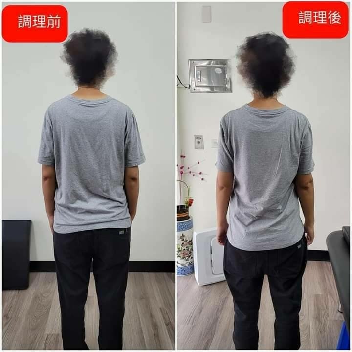 台南整骨推薦│元強仙骨微調│駝背拜拜！讓身體輕鬆站直，抬頭挺