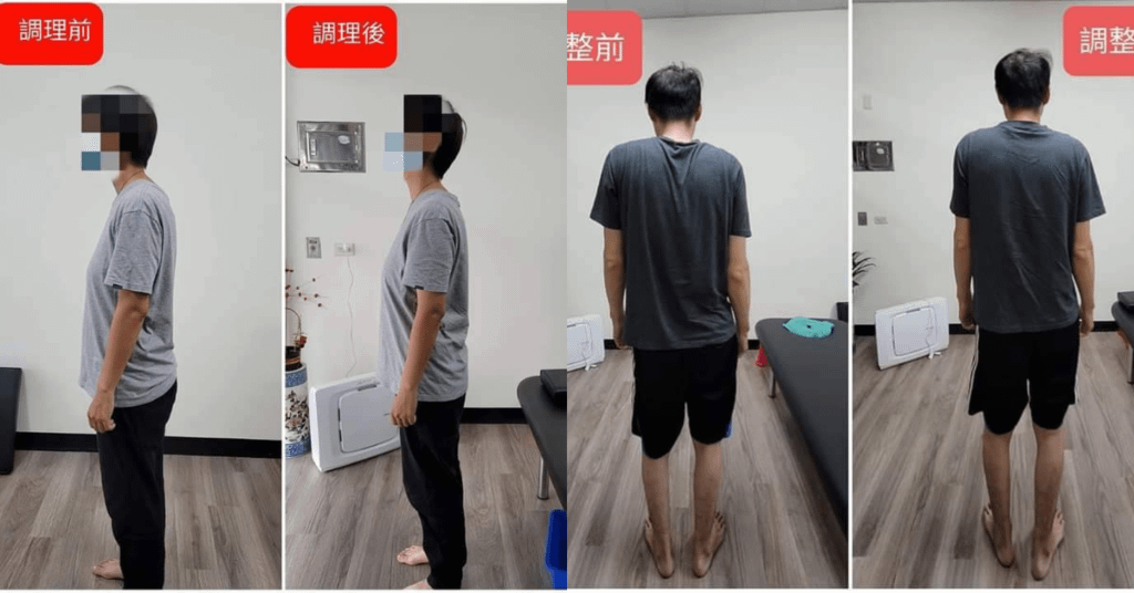 台南整骨推薦│元強仙骨微調│駝背拜拜！讓身體輕鬆站直，抬頭挺