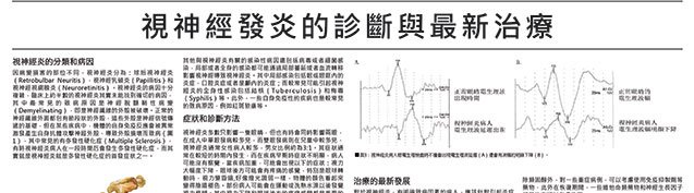 視神經發炎的最新治療方法.jpg