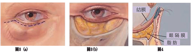 2圖1.gif