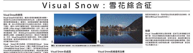 Visual Snow：雪花綜合征.jpg