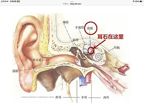 耳石復位術