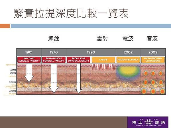 音波治療深度