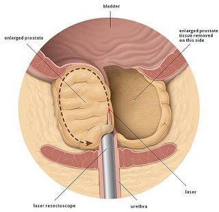 81556e_4d7e64413c20479ab6f4fe20b76843a0.jpg_srz_p_393_381_75_22_0.50_1.20_0.00_jpg_srz.jpg