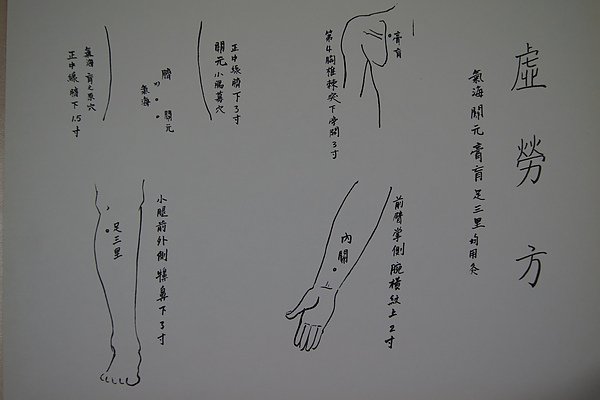 針灸方