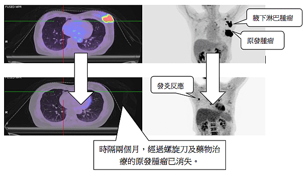 螢幕快照 2013-12-09 下午10.54.24