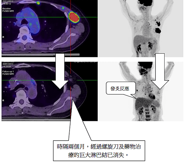 螢幕快照 2013-12-09 下午10.54.30