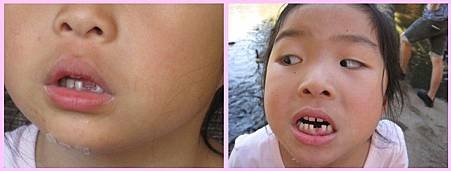 laceration-05.jpg