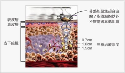 (6) 利欣 廖苑利推薦 眼袋手術推薦 電波拉皮推薦 玻尿酸淚溝推薦 標靶震波溶脂推薦 水刀抽脂推薦