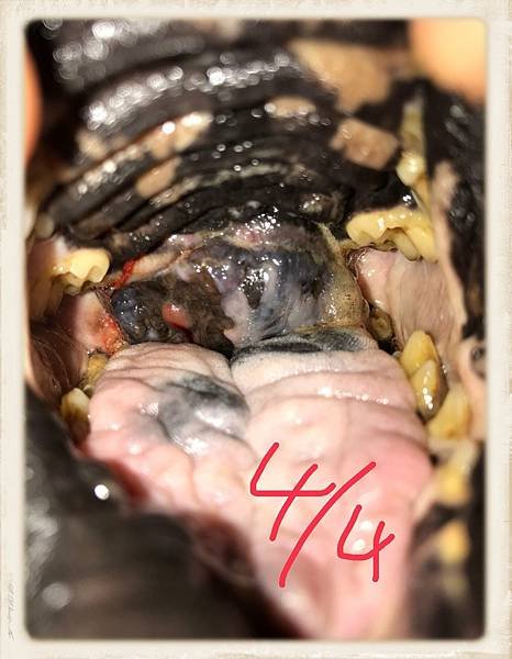 30黑色素瘤.jpg