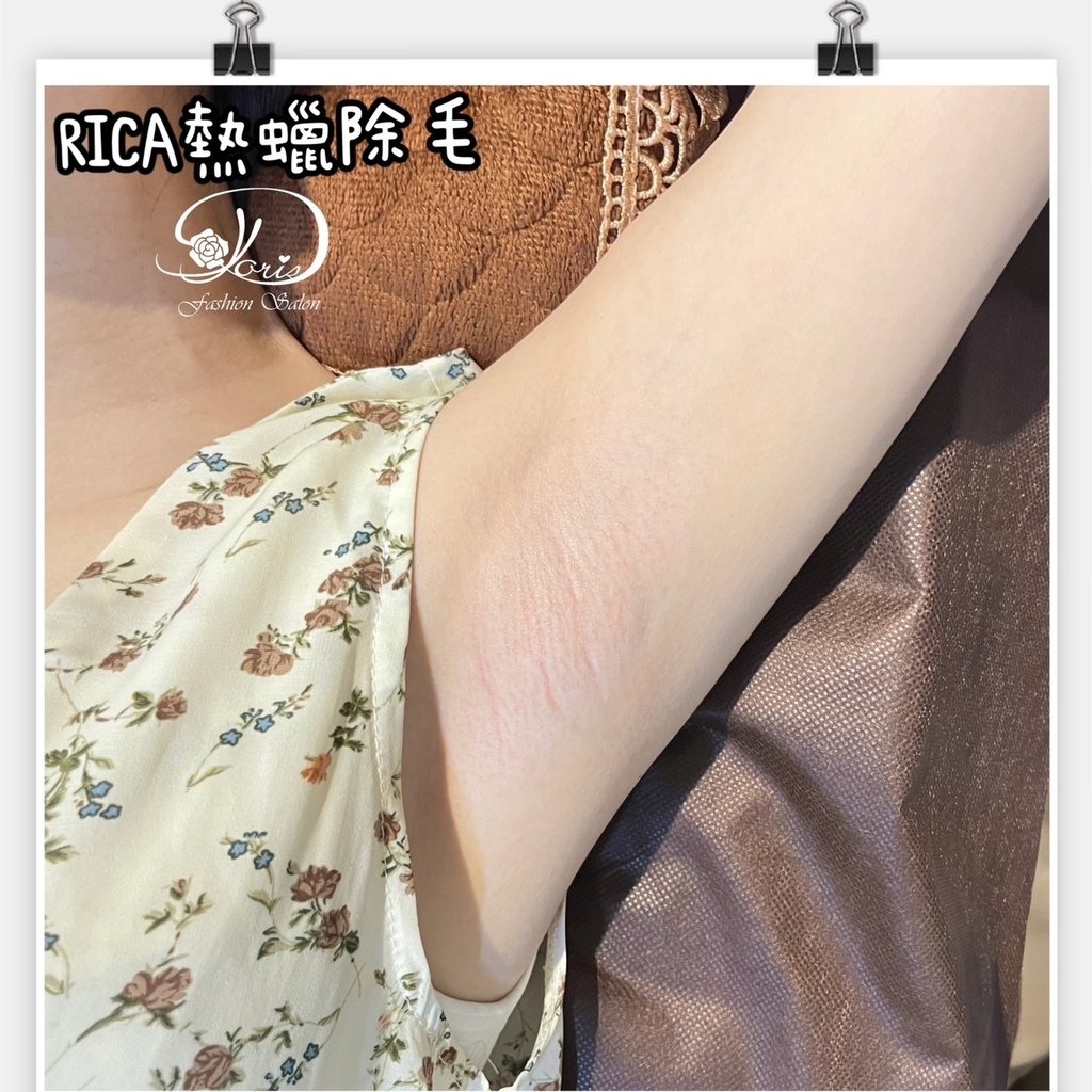 【RICA腋下除毛】定期除毛，毛髮不外露，保持清爽(◍•ᴗ•