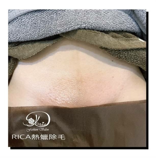 【台南巴西式除毛】這個夏天妳熱蠟除毛了嗎？ 夏天不外乎就是沙