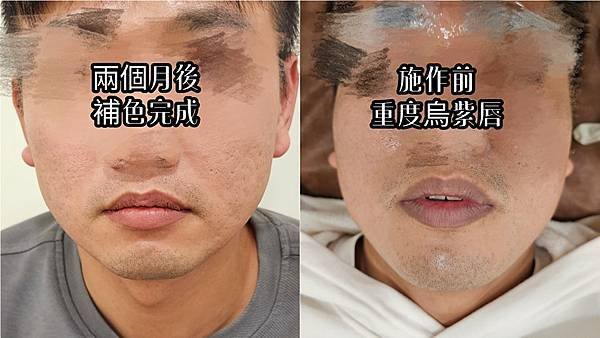 【男生唇色矯正】這個一定要跟你們分享！