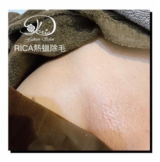 【台南熱蠟除毛】聽說熱蠟除毛可以幫妳告別惱人的毛髮重拾肌膚嫩