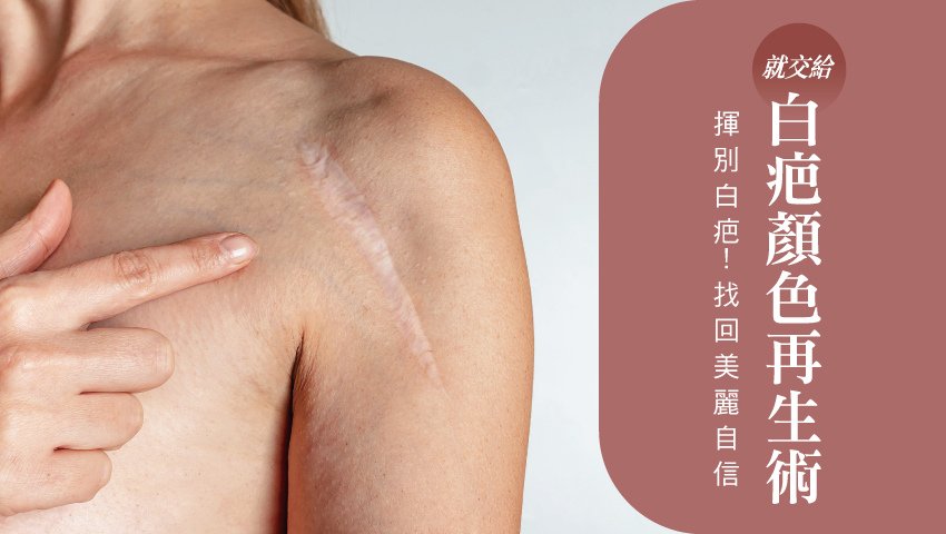 揮別白疤！找回美麗自信就交給「白疤顏色再生術」