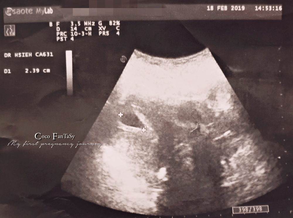 #孕期全記事 | My First Pregnancy Jo