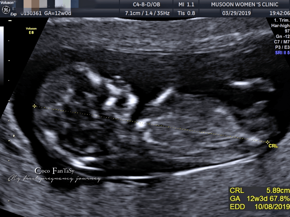 #孕期全記事 | My First Pregnancy Jo