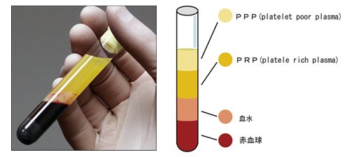 PRP1