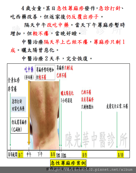 #陳光華中醫診所急性蕁麻疹案例分享.jpg