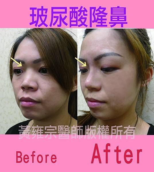 家純(鼻子)局部00000拷貝