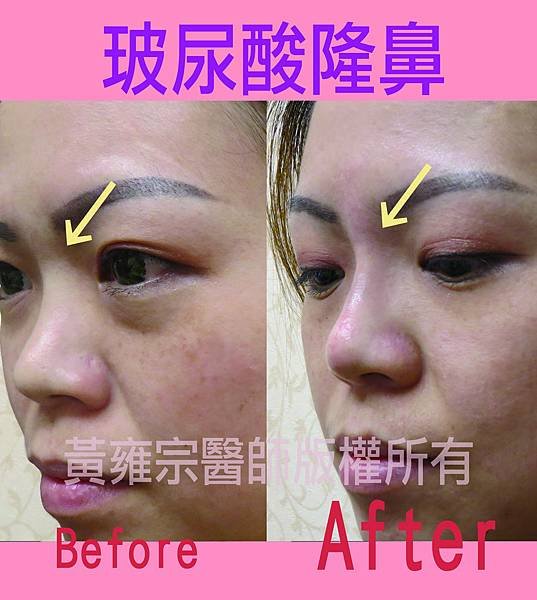家純(鼻子)局部0000拷貝