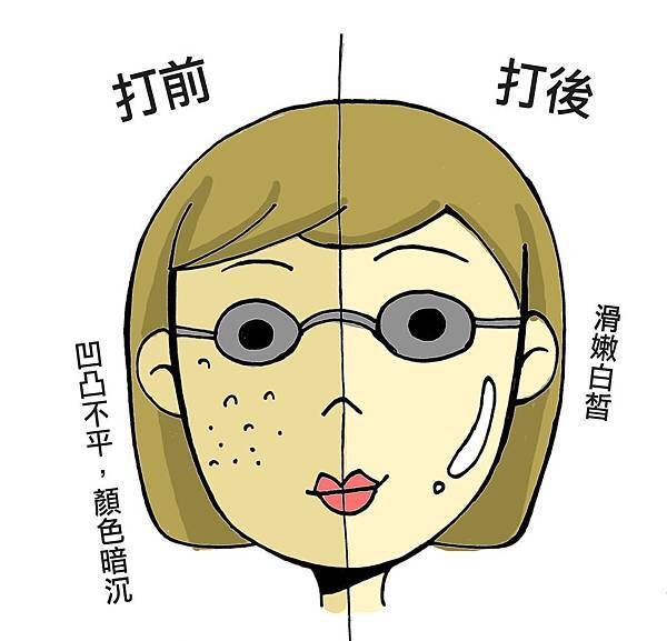 黃雍宗醫師- 脈衝光