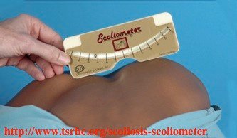 scoliometer