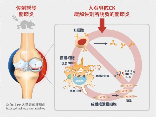 人蔘皂甙CK對免疫細胞和作用細胞的影響，或許可以緩解佐劑所誘發的關節炎