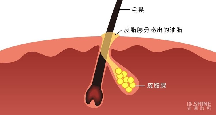 光澤診所毛孔粗大皮秒雷射蜂巢透鏡果酸杏仁酸複合式雷射面膜精華液 (2).jpg