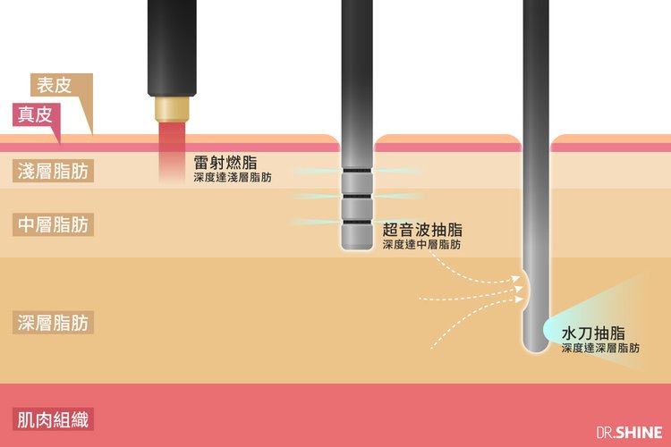 三種治療深度無治療