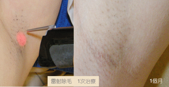 腋毛GIF.gif
