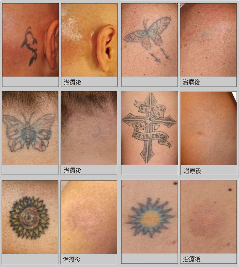 7刺青案例.jpg